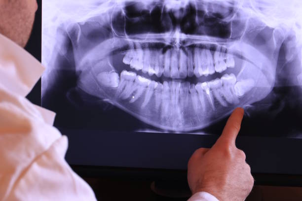 Best Teeth Whitening  in Jennings Lodge, OR