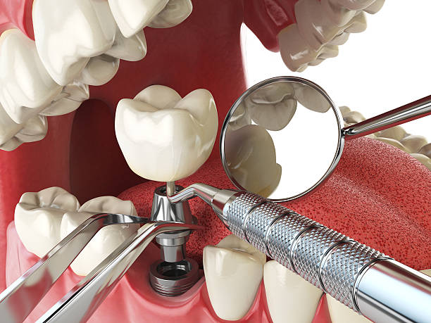 Best Tooth Pain Emergency Relief  in Jennings Lodge, OR